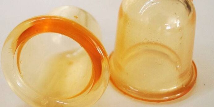 φλιτζάνια για τη θεραπεία της προστατίτιδας